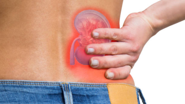 Vitamin D enhances calcium absorption that can lead to kidney stone formation