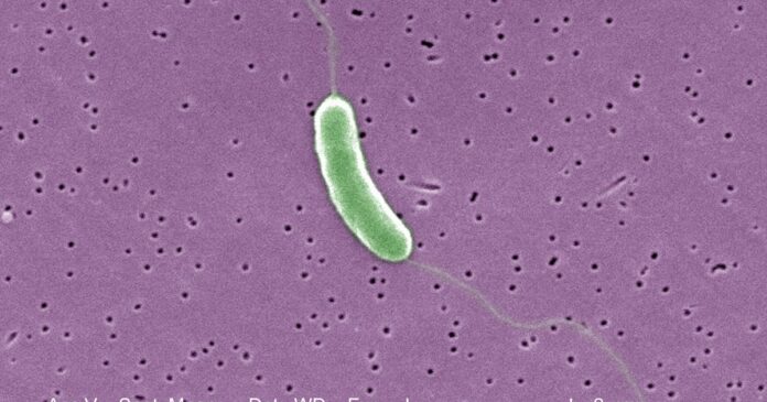 Flesh-eating-bacteria-kills-5th-person-this-year-in-Louisiana.jpg