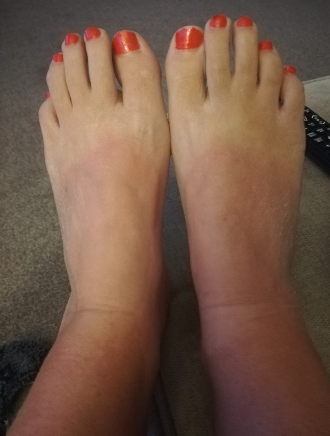 Ms Pearson now makes adaptations to her daily routine to avoid cold temperatures